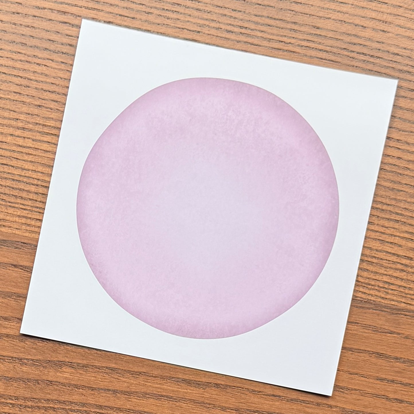 Red Blood Cell Morphology Print