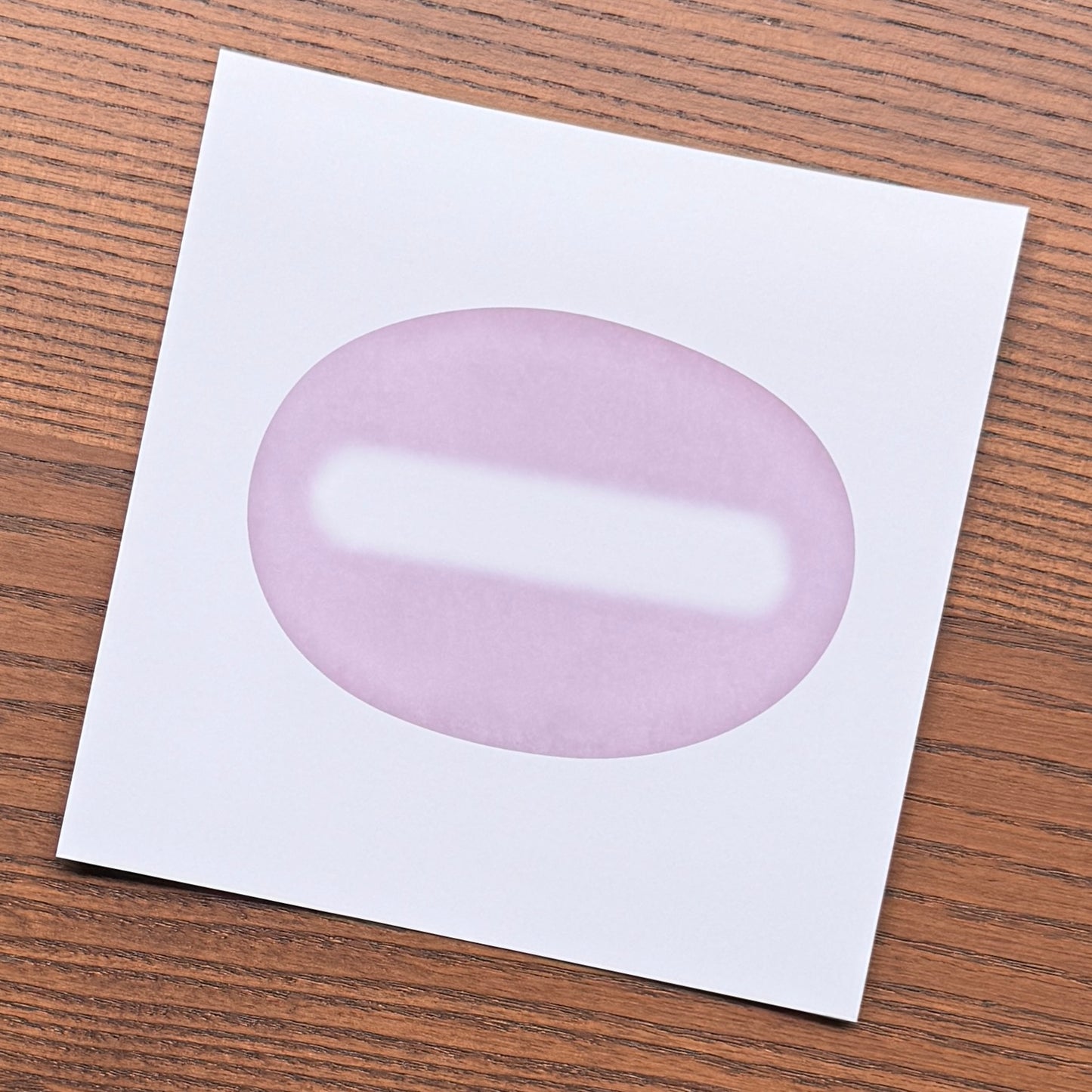 Red Blood Cell Morphology Print