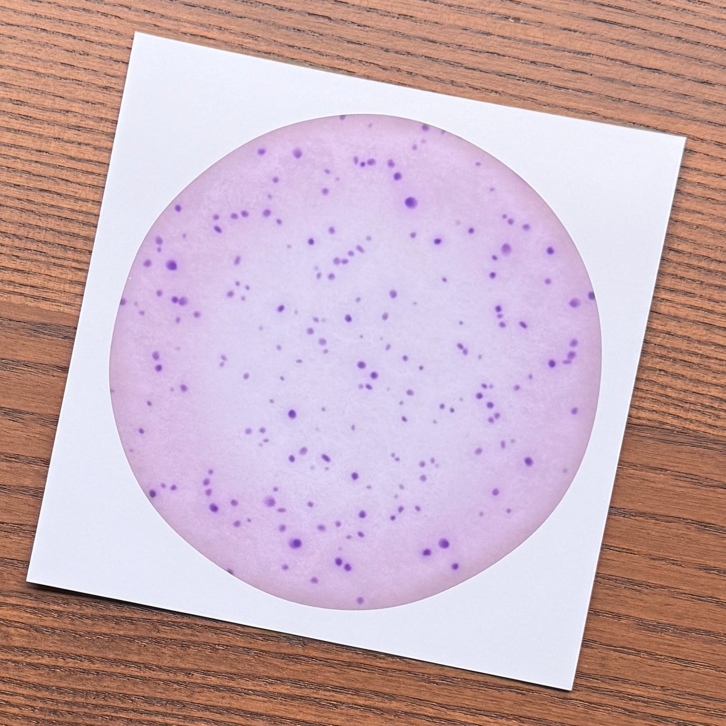 Red Blood Cell Morphology Print