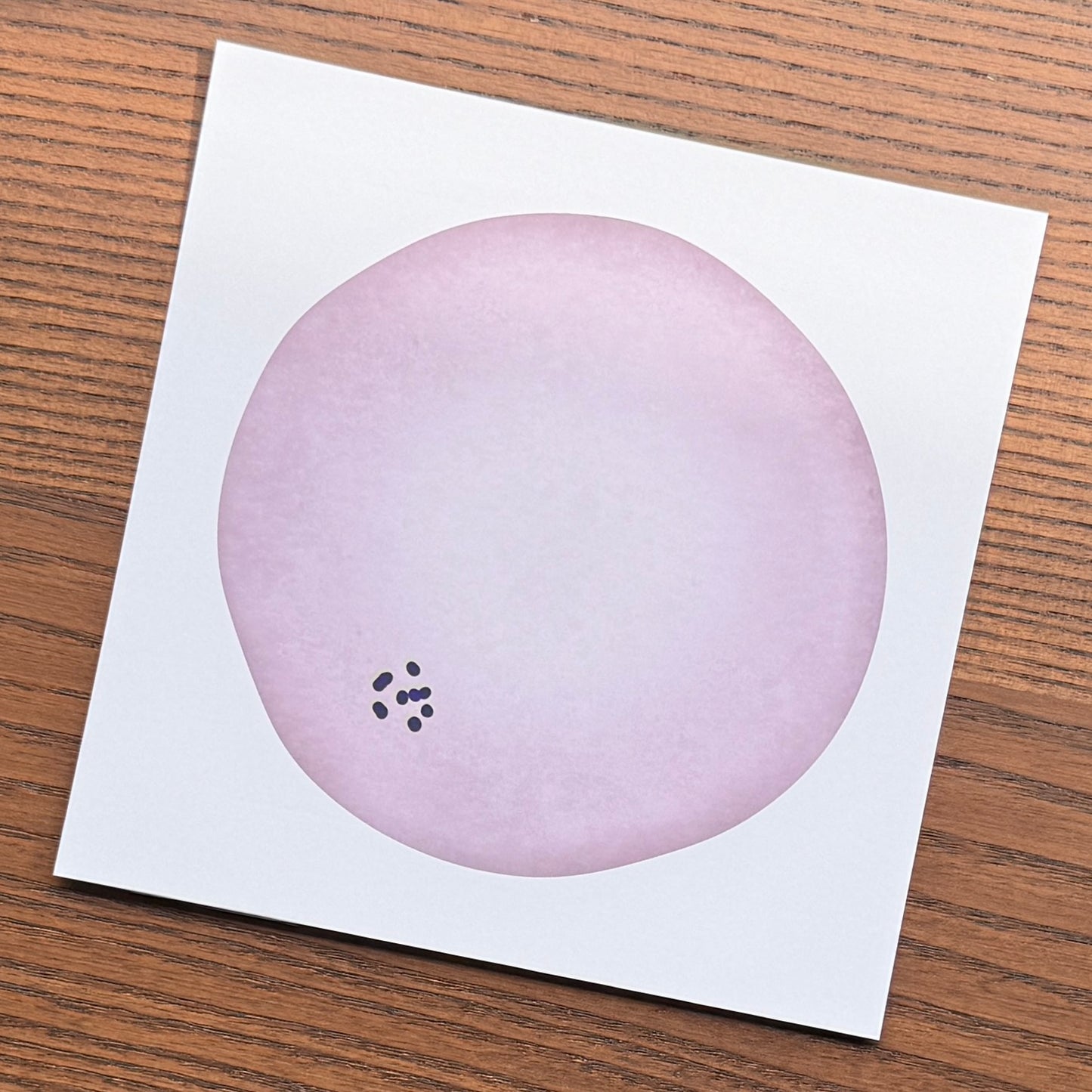Red Blood Cell Morphology Print