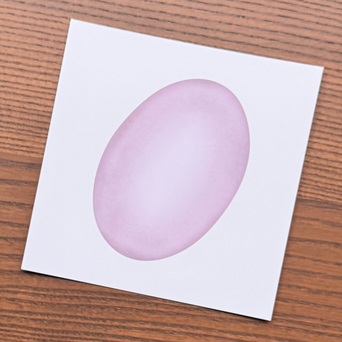Red Blood Cell Morphology Print