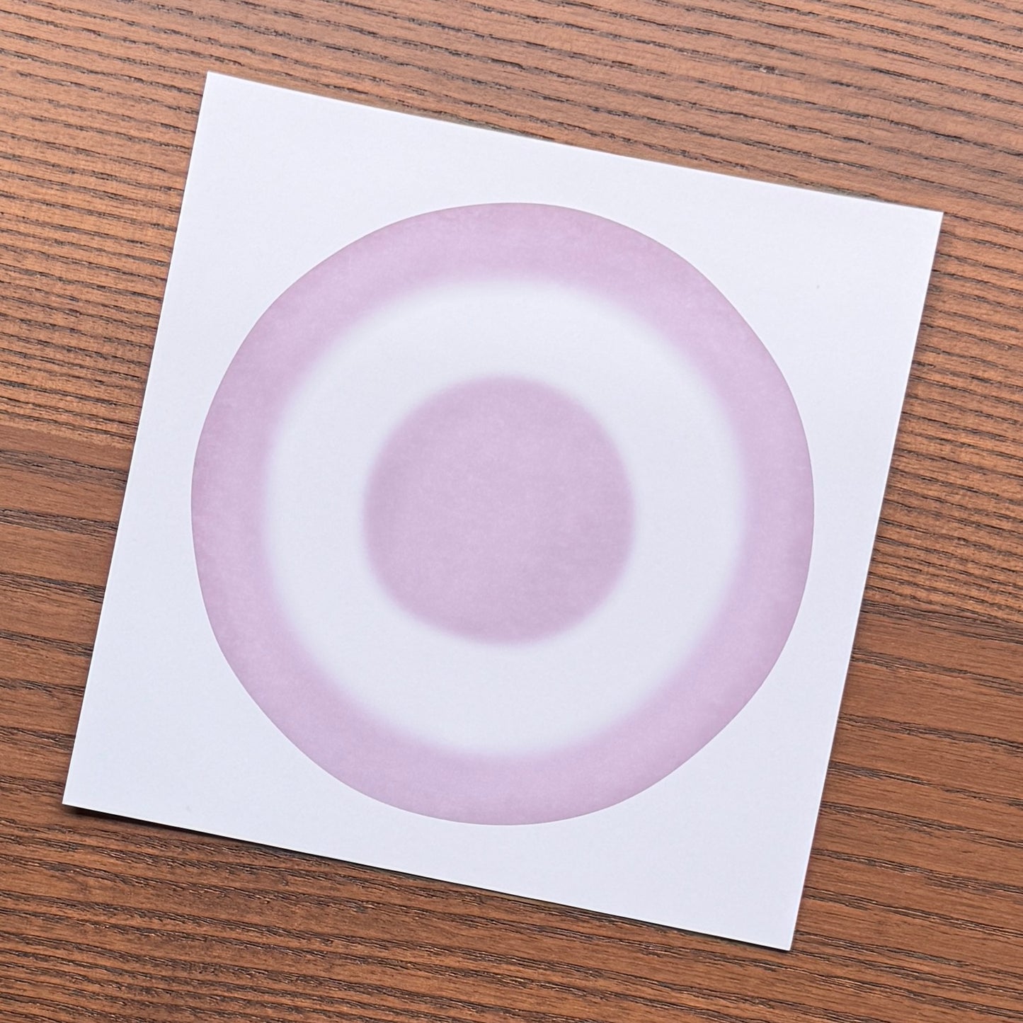 Red Blood Cell Morphology Print