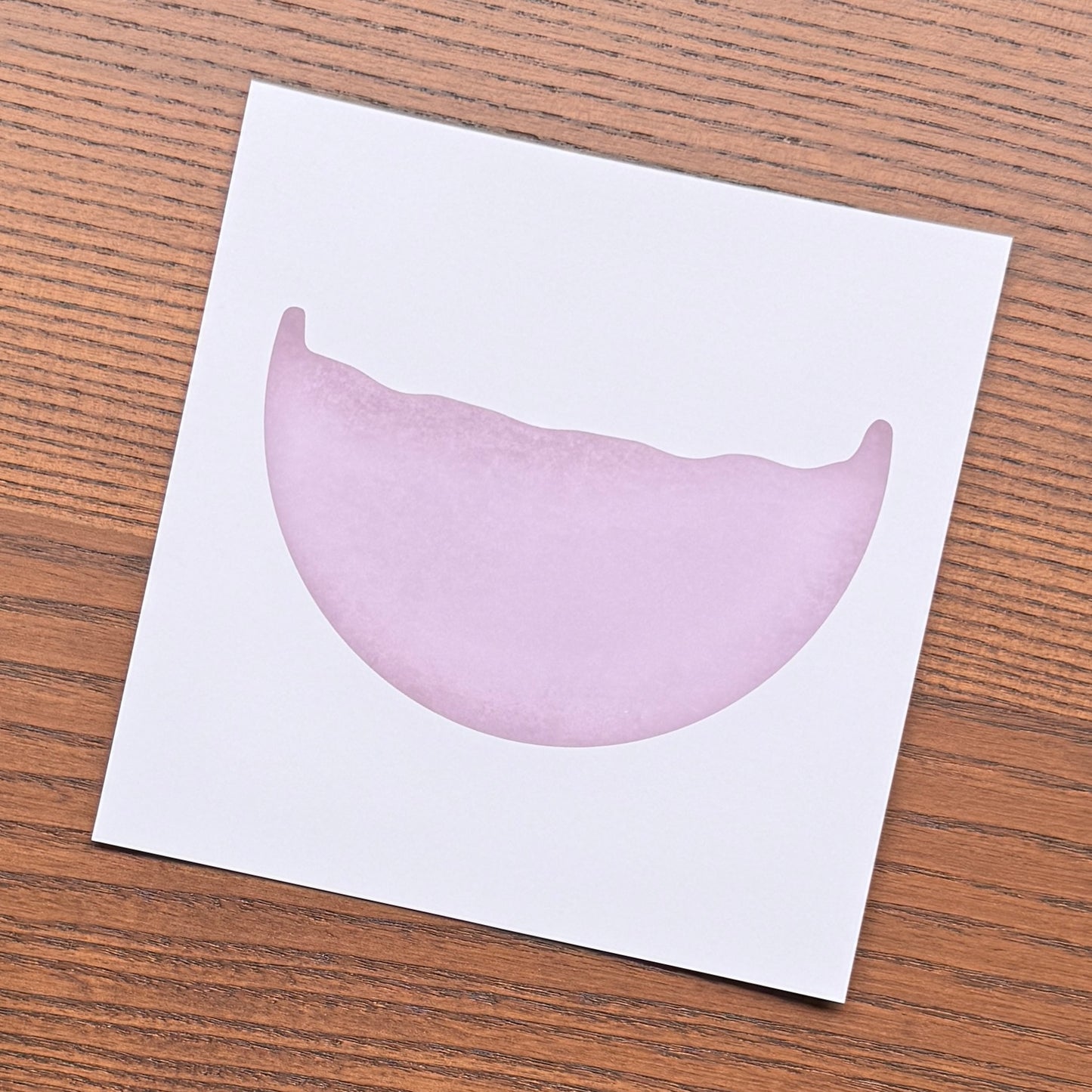 Red Blood Cell Morphology Print