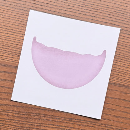 Red Blood Cell Morphology Print